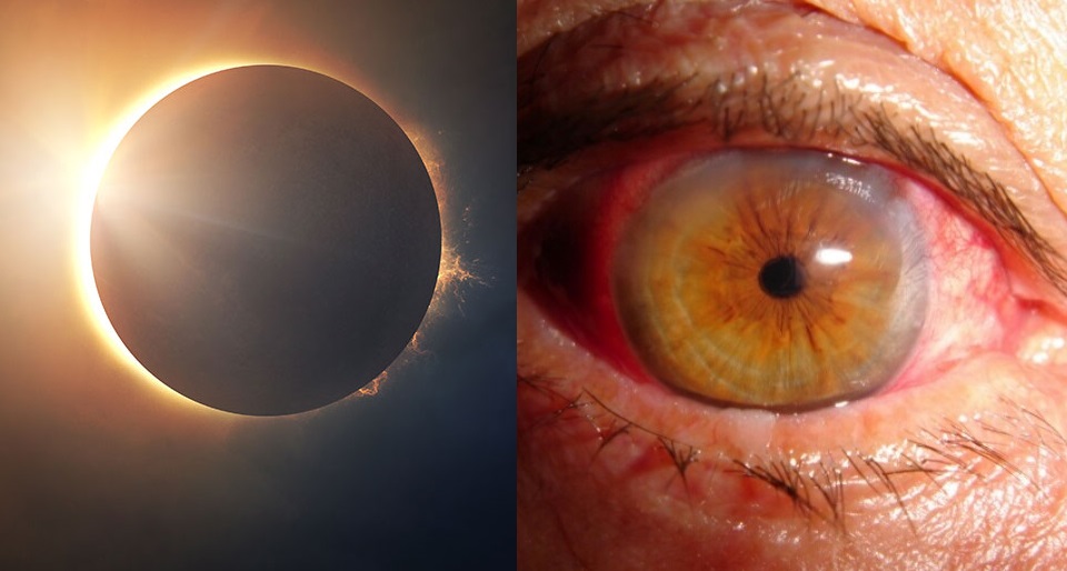 C Mo Ver El Eclipse Solar Y Prevenir La Retinopat A