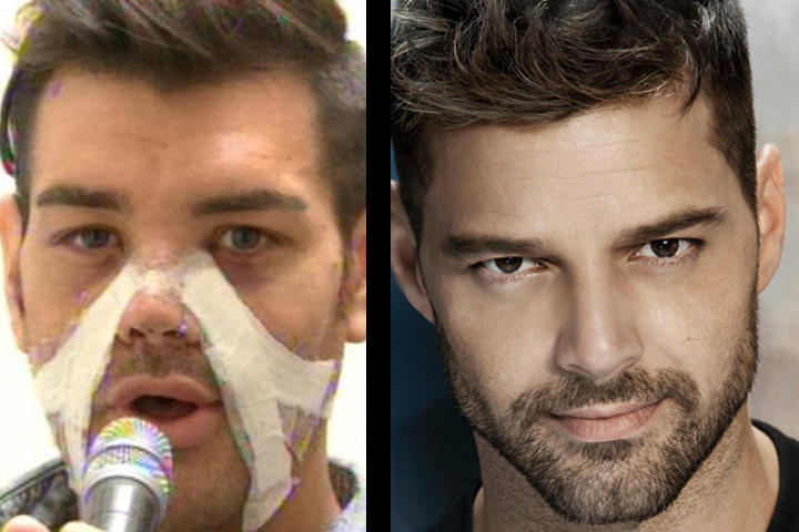 Se obsesiona con tener el rostro de Ricky Martin