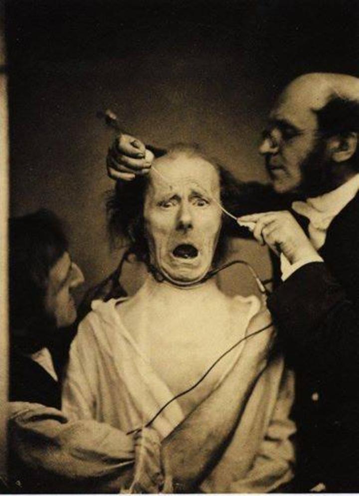Cinco escalofriantes imágenes de la medicina del pasado