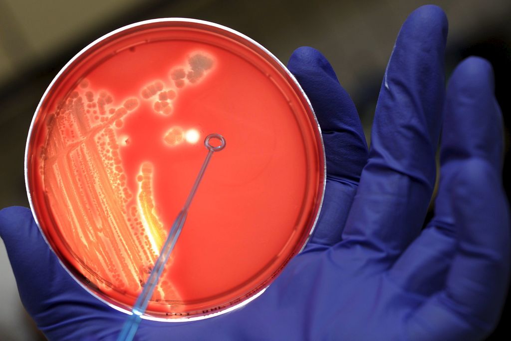 Un mecanismo de las bacterias que potencia su poder patógeno
