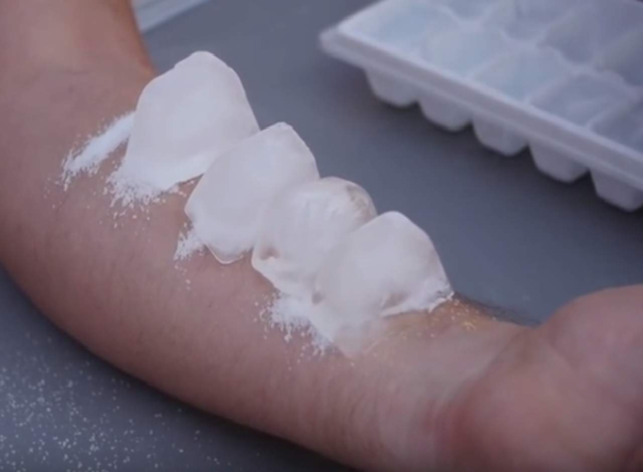 Salt and Ice Challenge, un nuevo reto viral que provoca severas lesiones