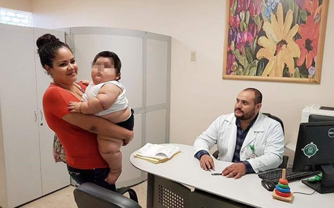 Bebé de 10 meses pesa 28 kilos por deficiencia de grasas en madre