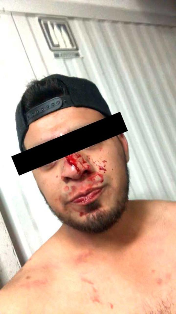 Estudiante en Monclova recibe golpiza; acusa a su exnovia