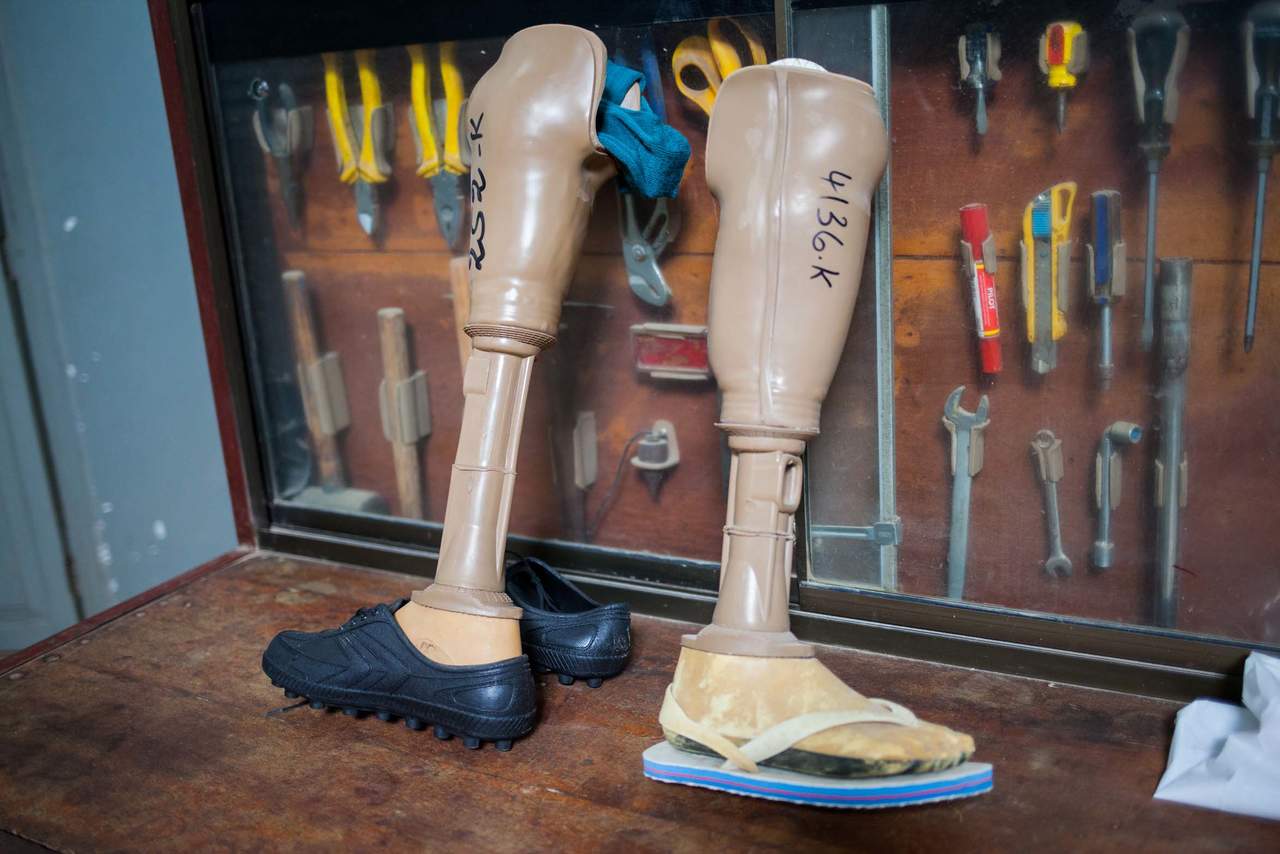 Diseñan pie protésico de bajo costo que imita la caminata natural