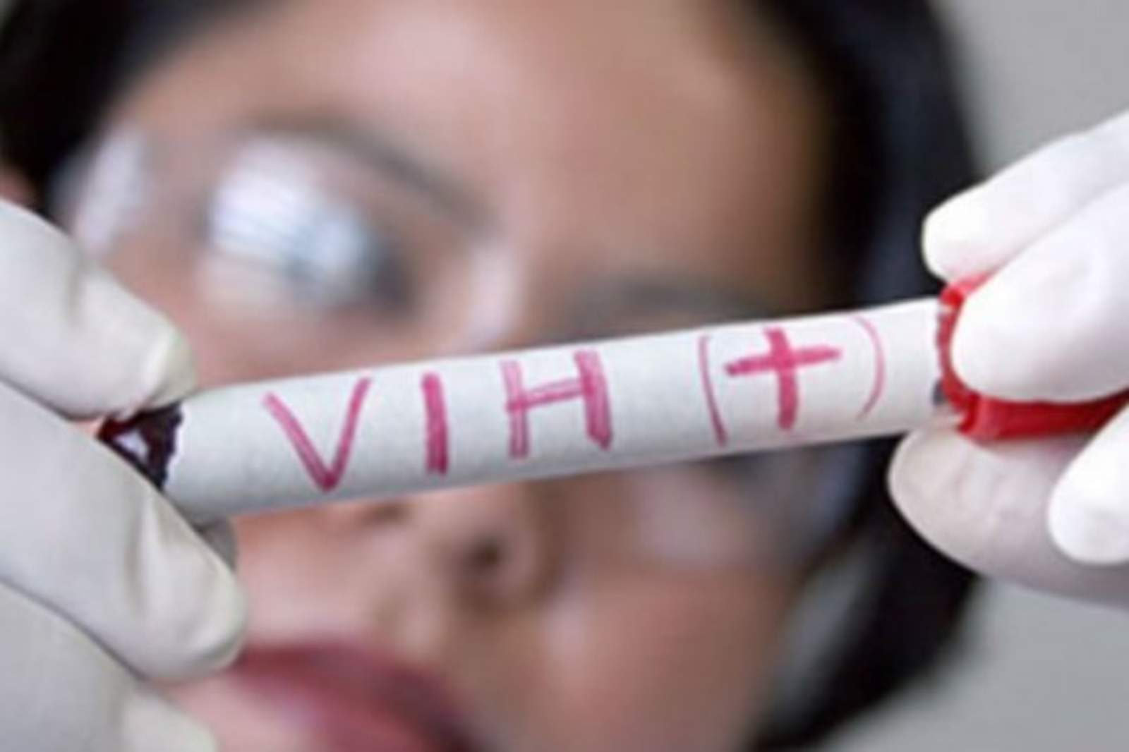 Reportan 42 casos nuevos de VIH/Sida en la región