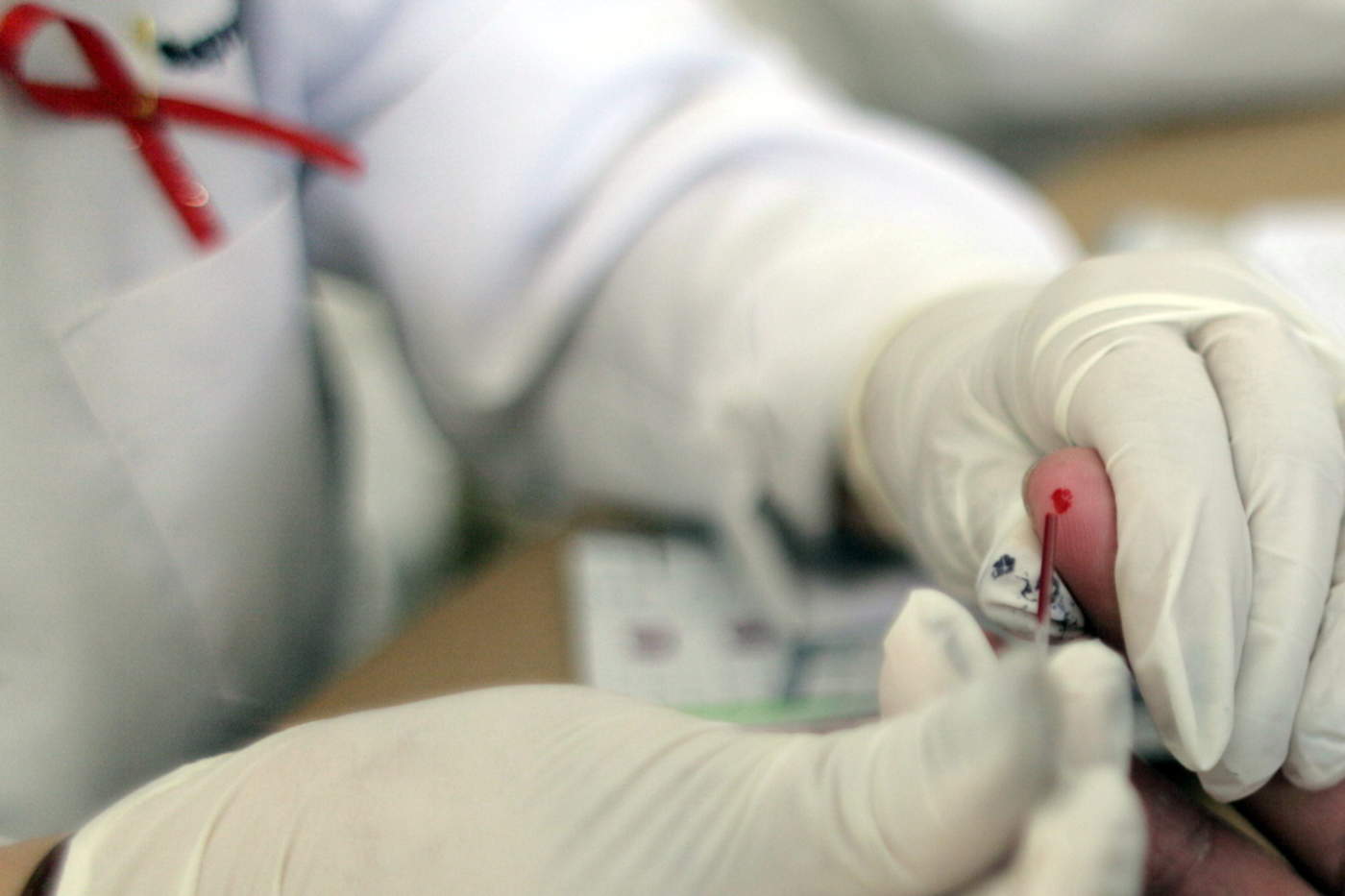 Tras trasplante, británico suma 18 meses sin rastro del VIH