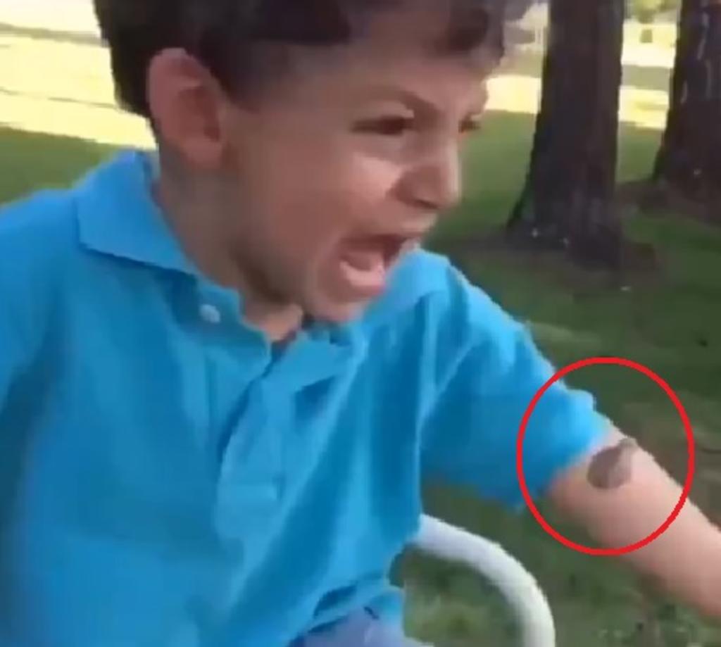 Reacción de niño se vuelve viral al saltarle una rana a su boca