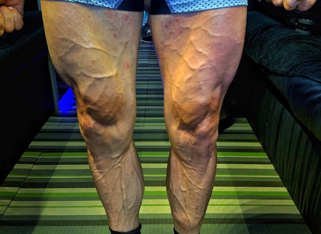 Ciclista impresiona con imagen de sus piernas tras competición