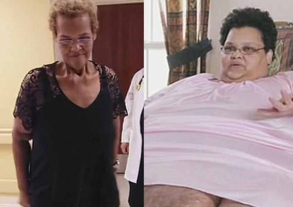 VIRAL: Mujer con obesidad mórbida logra bajar 270 Kg