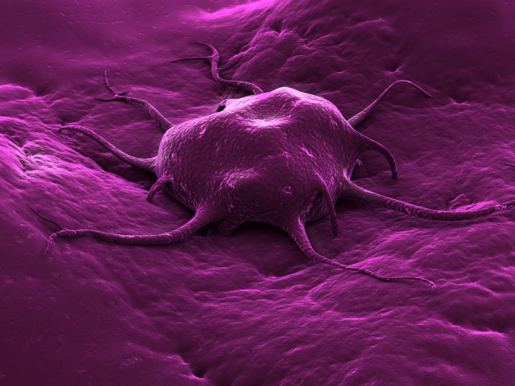 Identifican nueva forma de eliminar células cancerígenas