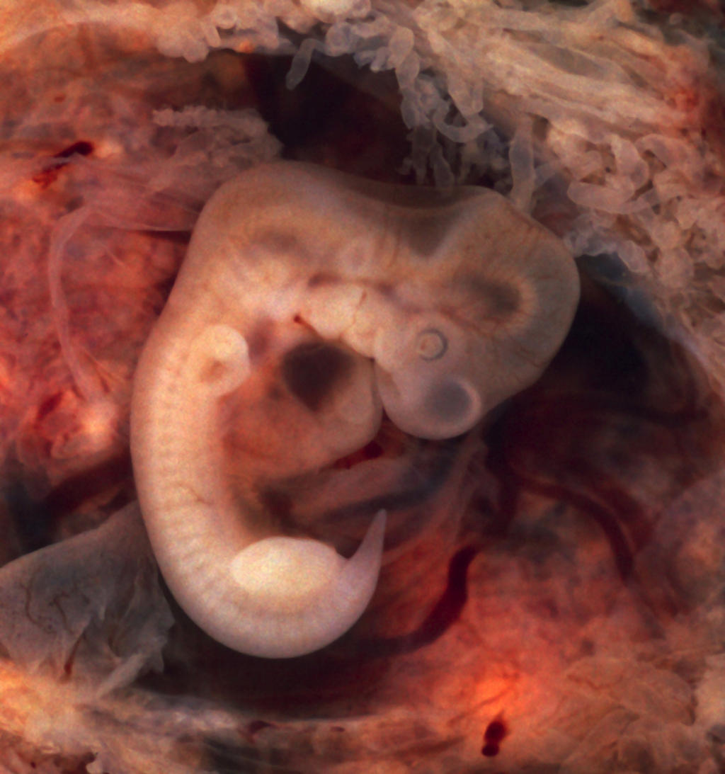 ¿Por qué la bioética permite el aborto hasta las 12 semanas?