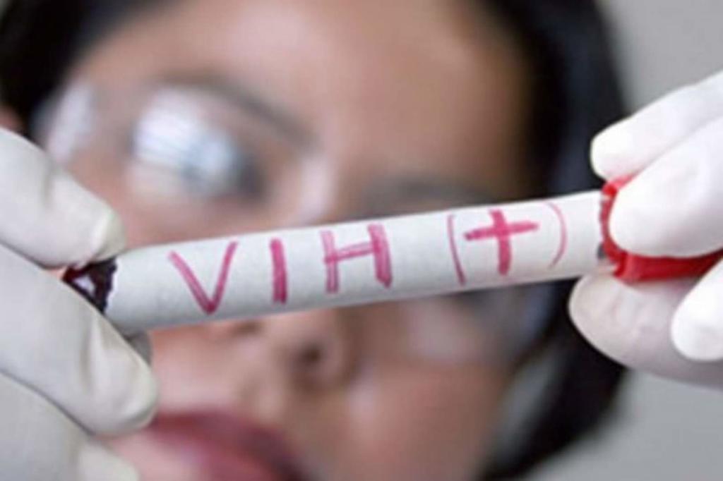 Terapia mejora calidad de vida de pacientes con VIH