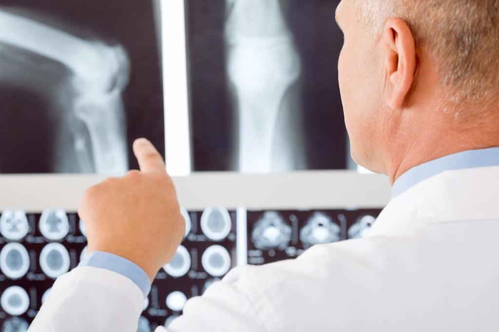 Osteoporosis cuesta a México más de 400 mdd anuales