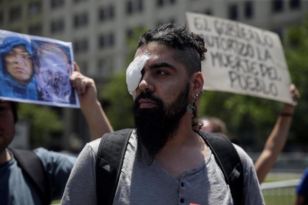 Manifestantes con daño ocular exigen justicia en Chile