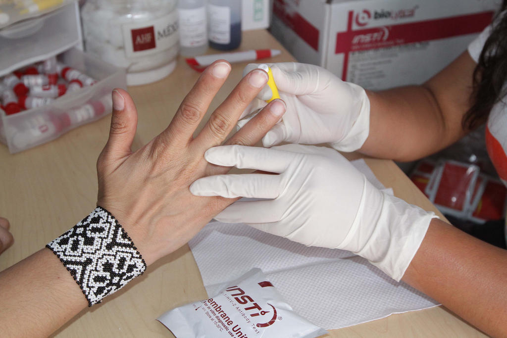 Atiende IMSS a casi 60 mil pacientes con VIH en 2019