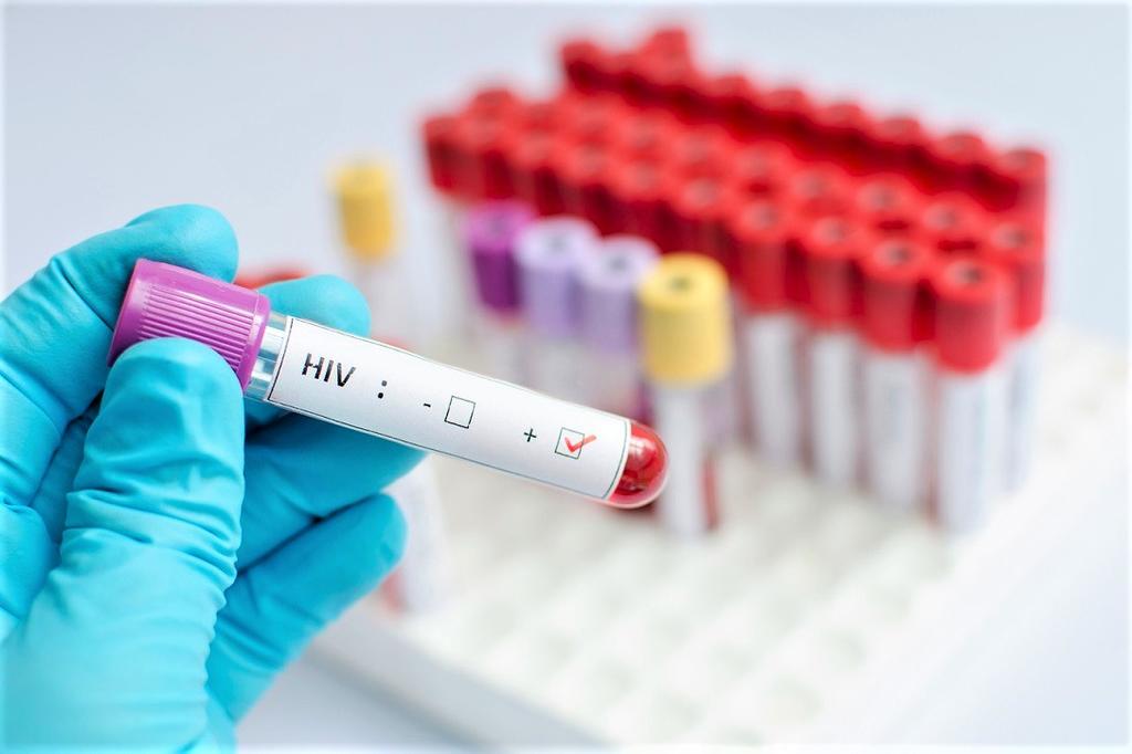 Población de entre 25 y 39 años, la más susceptible de contraer VIH