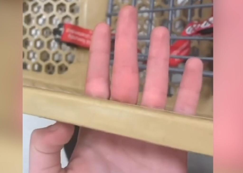 A adolescente se le quedan atrapados los dedos en un carrito de compras