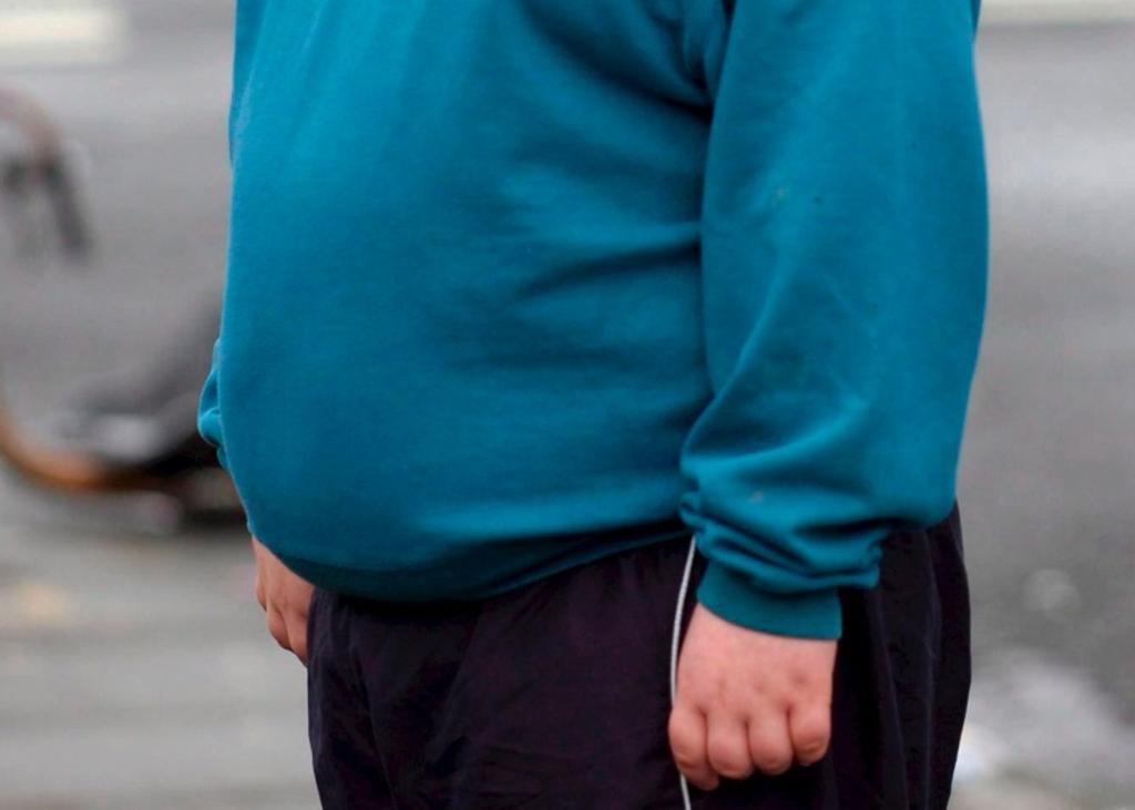 Obesidad infantil, un grave problema de salud en México