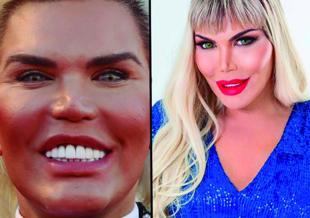 Rodrigo Alves; el 'Ken humano' hace transición a 'Barbie humana'