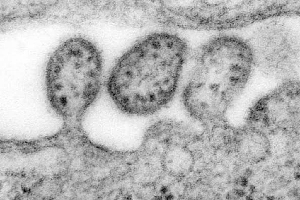 ¿Qué es el arenavirus, la enfermedad letal que regresó a Brasil?