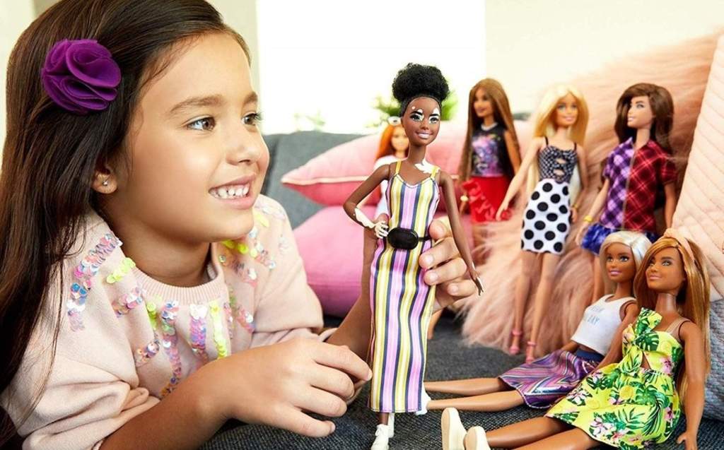 Barbie lanza muñecas con vitiligo y sin cabello