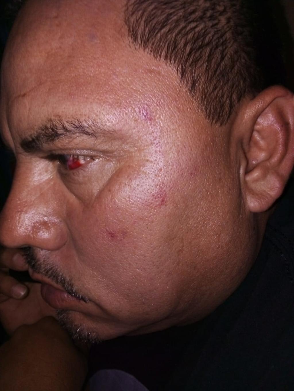 Diputado de Coahuila golpea a exdirigente panista en San Pedro y a su esposa