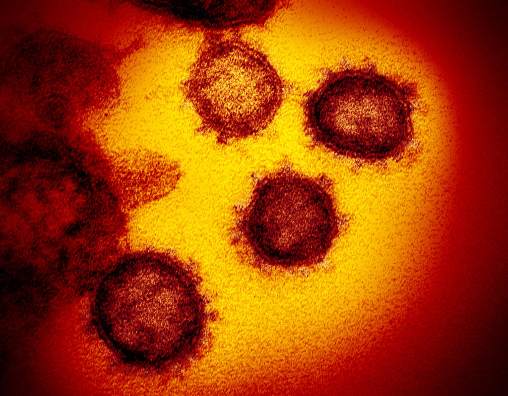 Coronavirus ha infectado a más de 64,000 personas