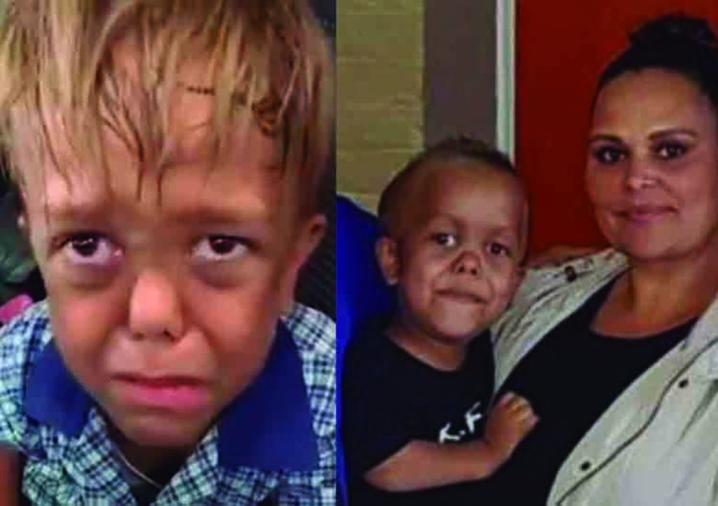 VIDEO: Niño con enanismo le pide soga a su mamá para suicidarse tras bullying