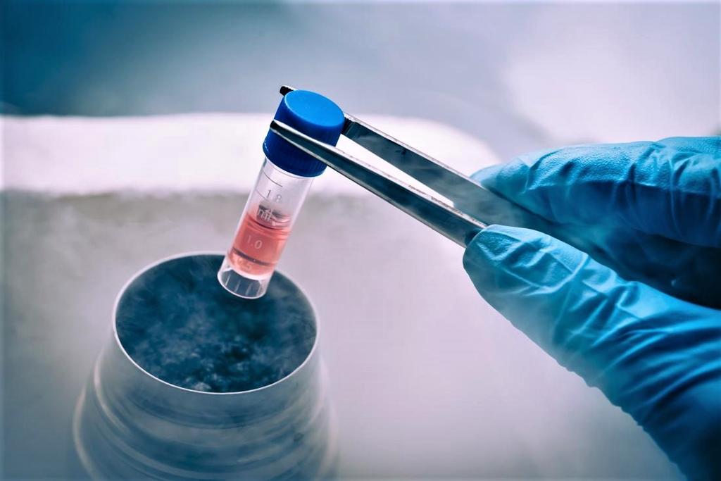 ¿Qué son las células madre que curaron por segunda ocasión el VIH?