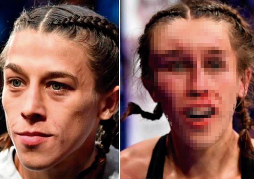 VIRAL: El antes y después de luchadora de UFC impacta a la red