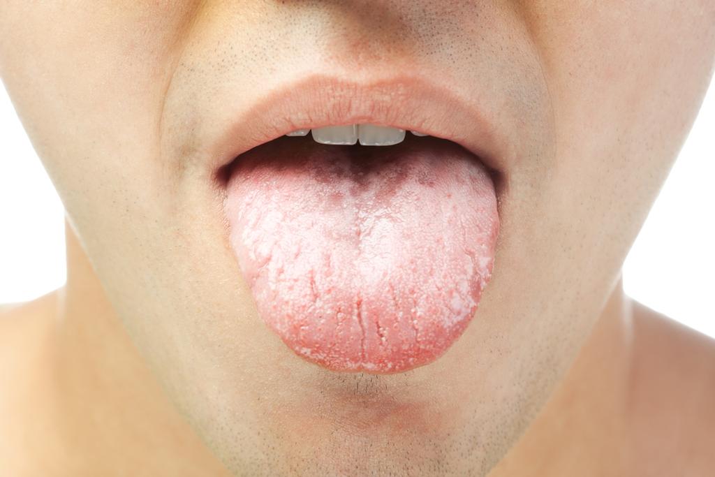 Nueva técnica muestra cómo se organizan las bacterias de la lengua
