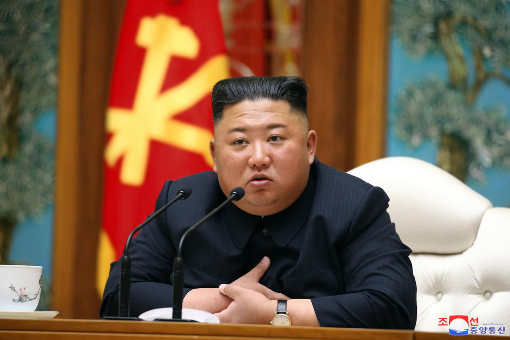 EUA 'sigue de cerca' los supuestos problemas de salud de Kim Jong-un