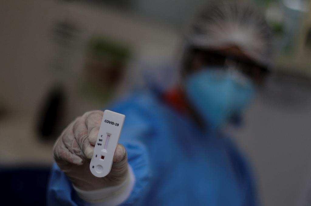 Autoriza Brasil hacer test rápidos de coronavirus en las farmacias