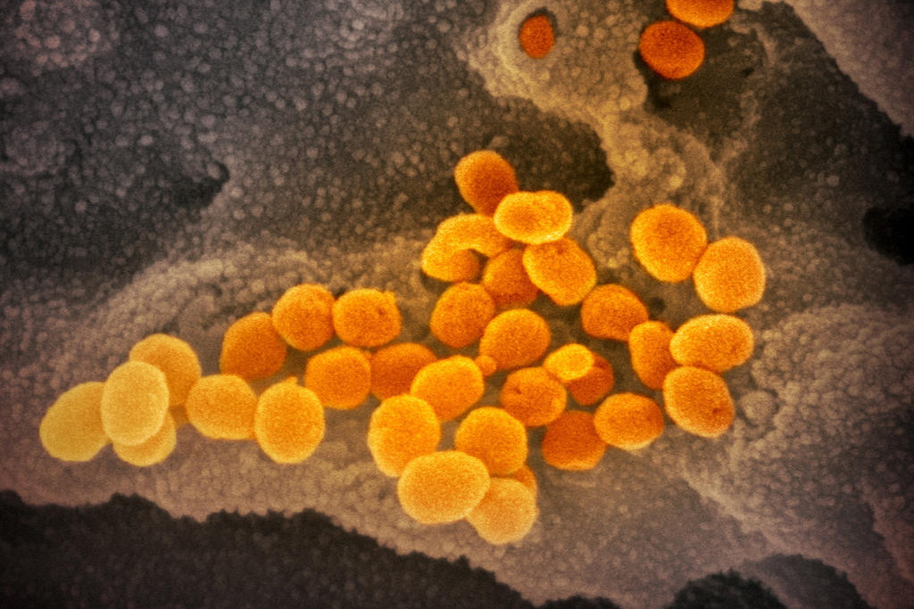Encuentran SARS-CoV-2 en semen de infectados: estudio