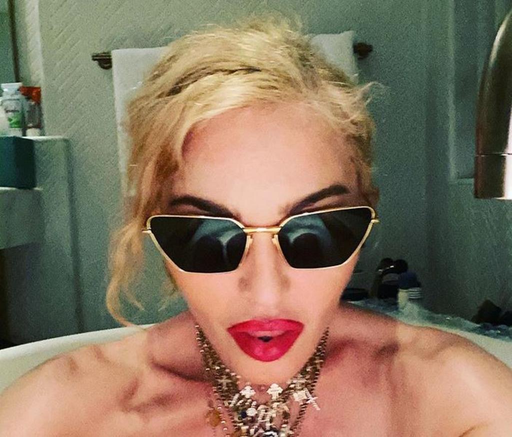 Madonna celebra tratamiento de cartílago en lencería