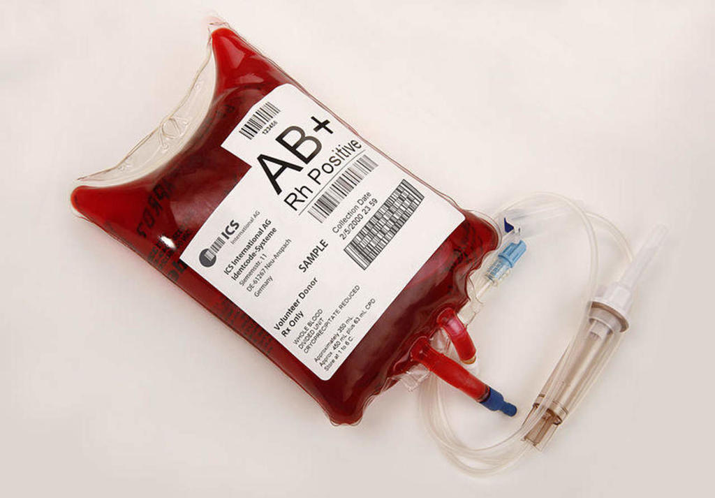 ¿Cuáles son los tipos de transfusión sanguínea?