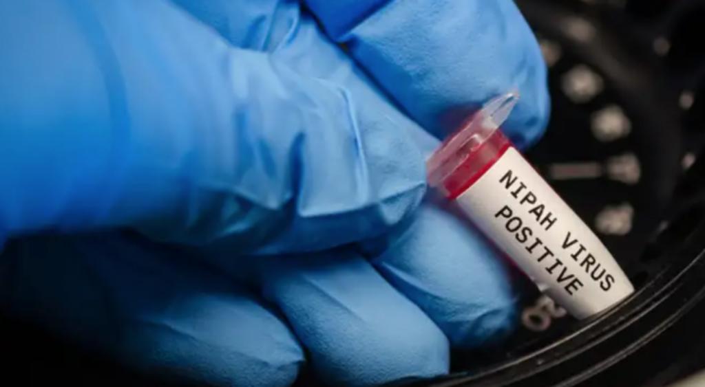 ¿Nuevo brote por virus Nipah? Autoridades se pronuncian ante 'alerta' de éste