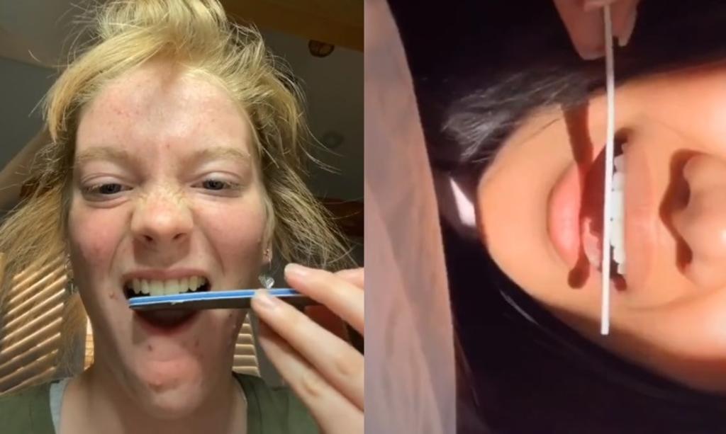 Limarse los dientes, la nueva tendencia viral en TikTok