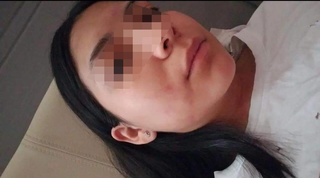 Joven denuncia a su novio en Torreón por lesiones, amenazas y daño psicológico