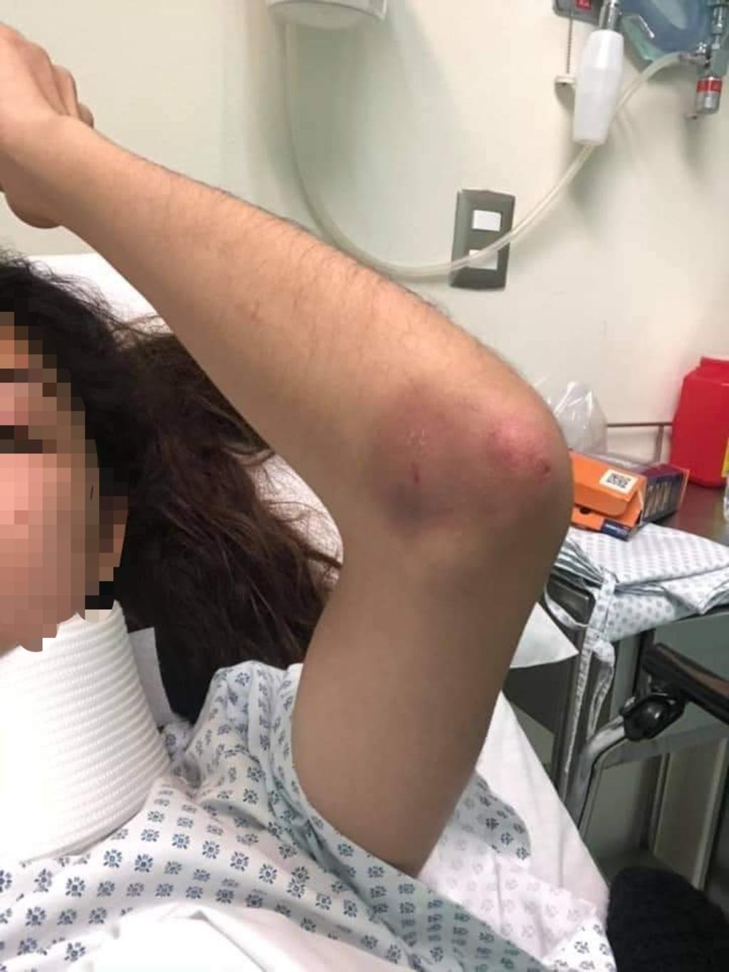 FGE abre indagación tras denuncia en redes sociales de mujer golpeada en Saltillo