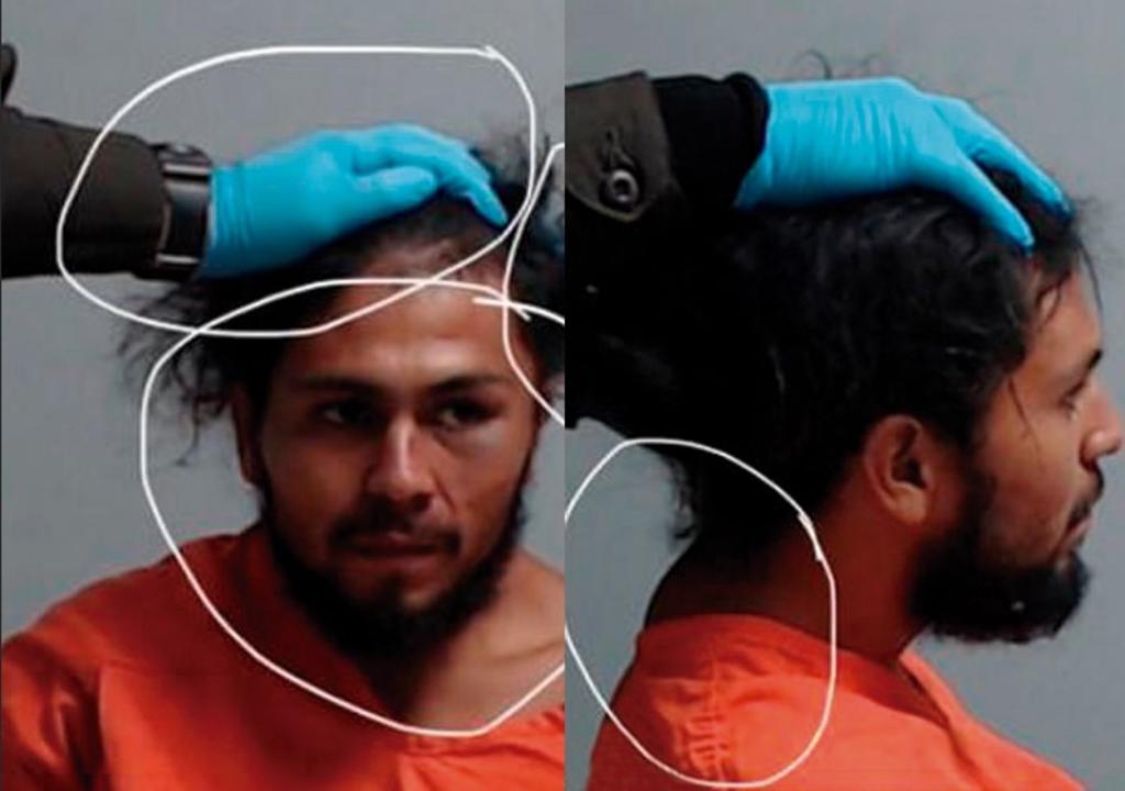 Policías sostienen cabeza de detenido para 'mugshot' tras romper su cuello