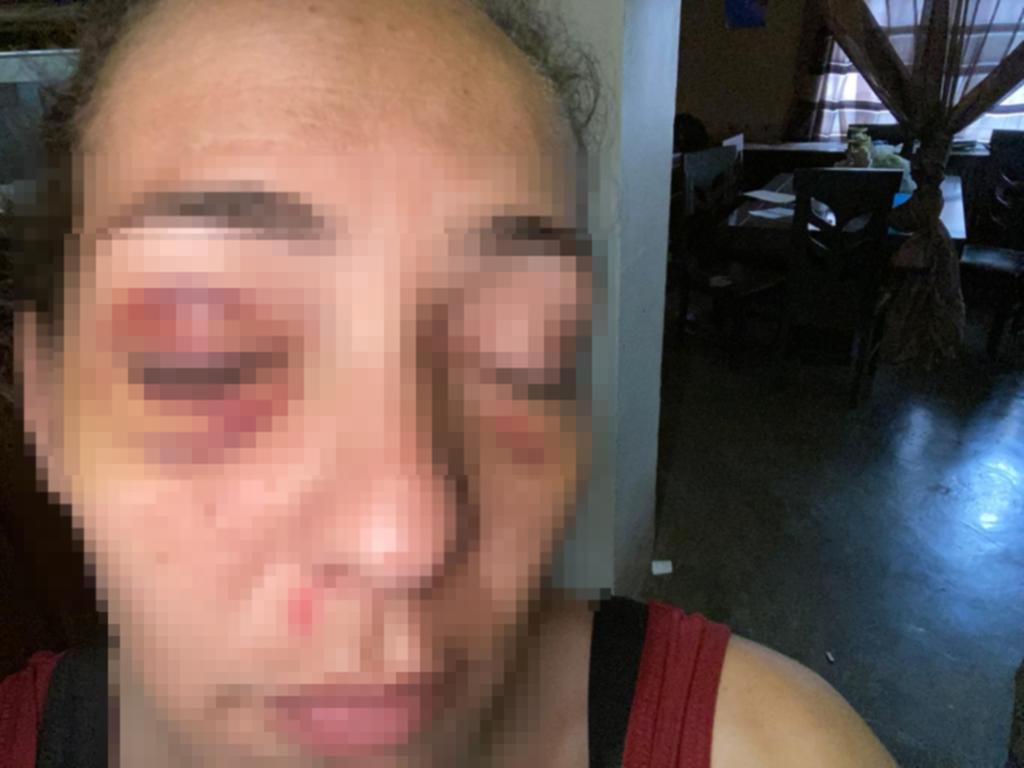 Denuncia por tortura e intento de homicidio a su pareja en San Buenaventura
