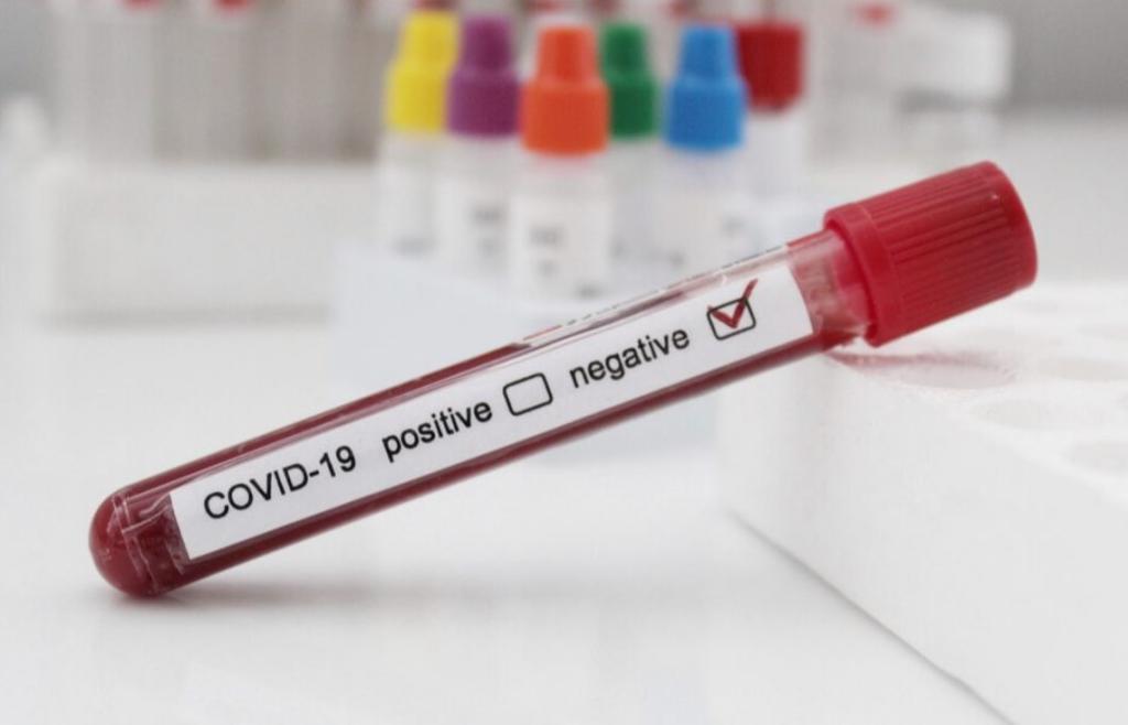 Sangre tipo O podría ser menos propensa a contagios por COVID-19