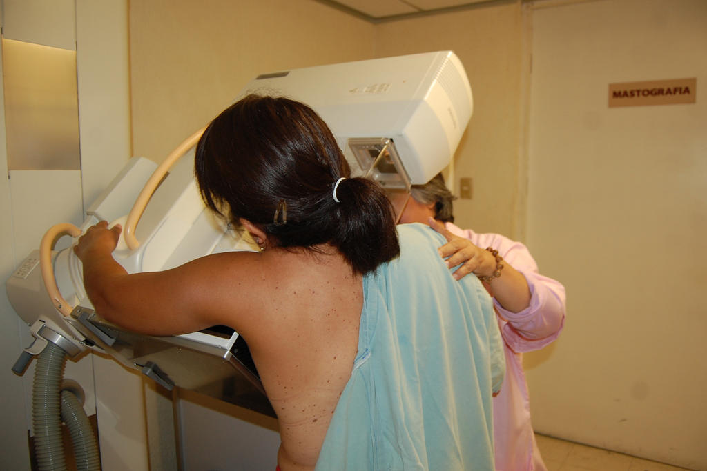 Interrumpe 86 % de mujeres tratamiento de cáncer de mama