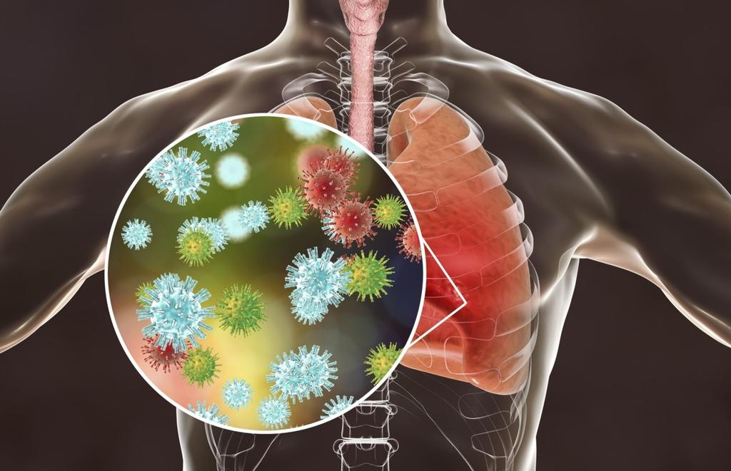 Pulmones de pacientes COVID-19 tardarían hasta tres meses en recuperarse