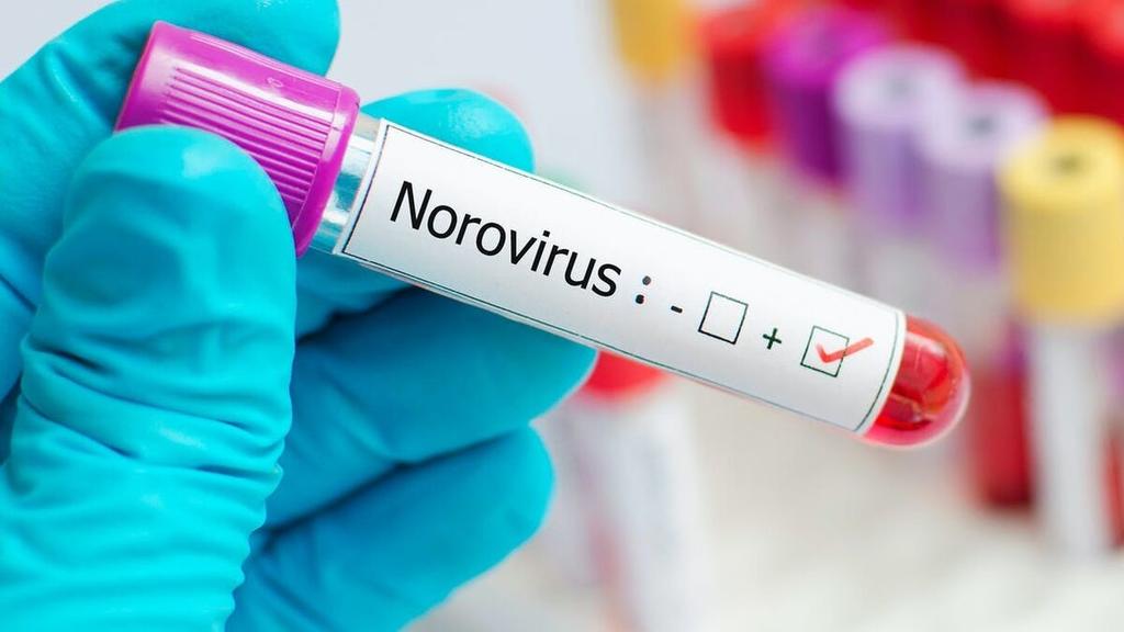 ¿Qué es el Norovirus? Otro virus que 'amenaza' a China