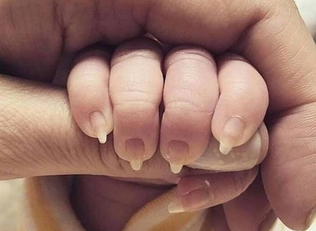 Madre causa pavor al compartir una fotografía de las uñas de su bebé