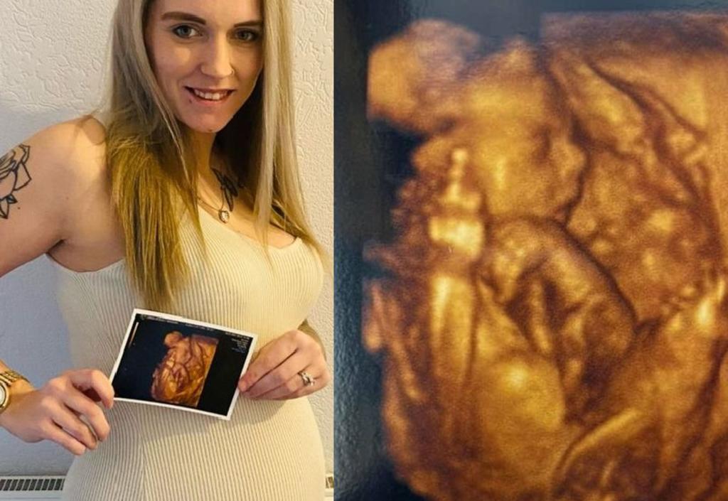 Bebé parece mostrar el dedo medio en imagen de ultrasonido
