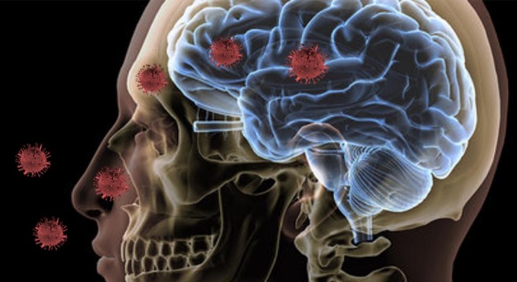 Estos son los daños que el COVID-19 puede ocasionar al cerebro