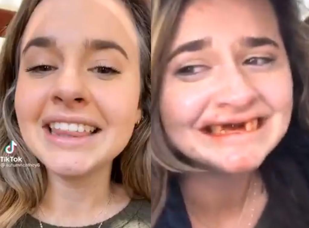 Joven pierde sus dientes al grabar video para TikTok